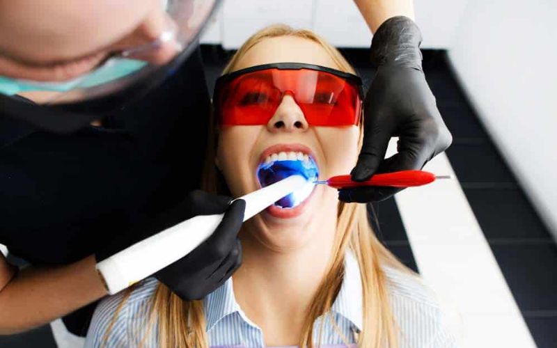 the benefits of modern tooth colored fillings