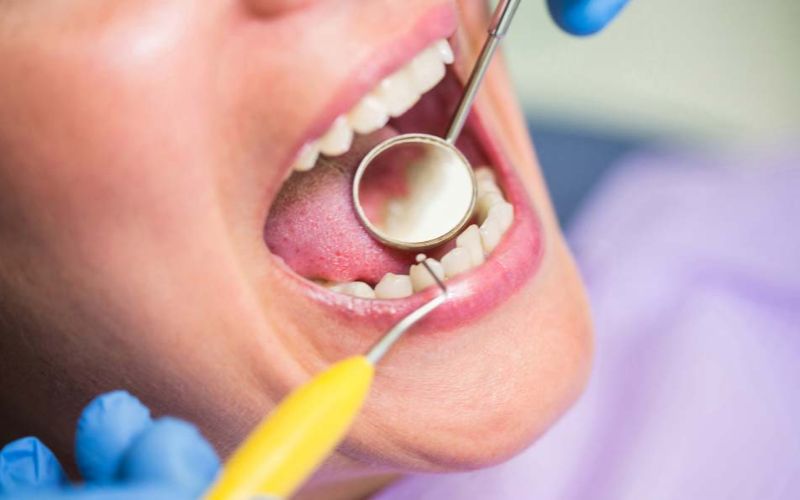 what is the best treatment for tooth decay