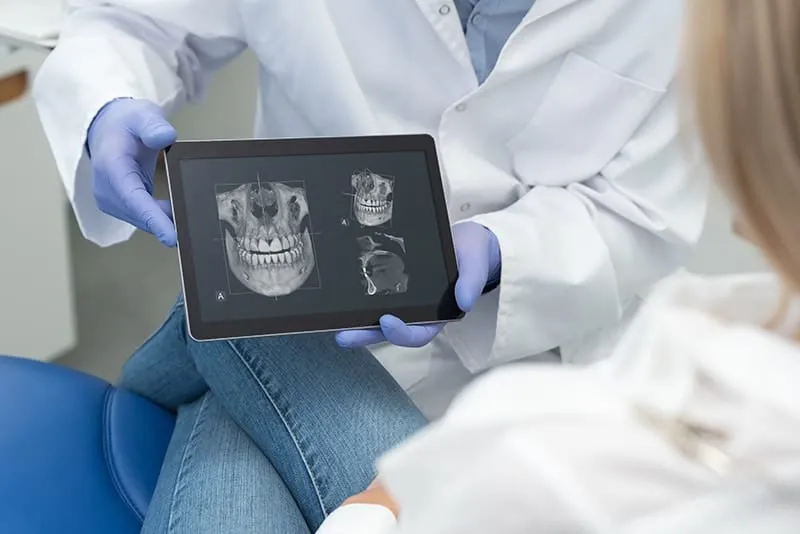 digital xray 3