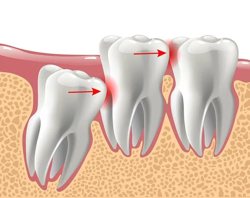 emergency dental 2