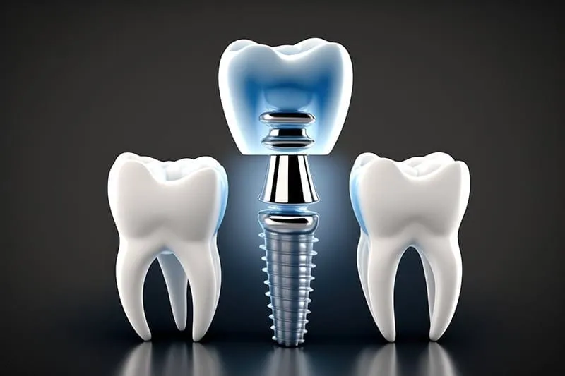 failed implant treatment 2